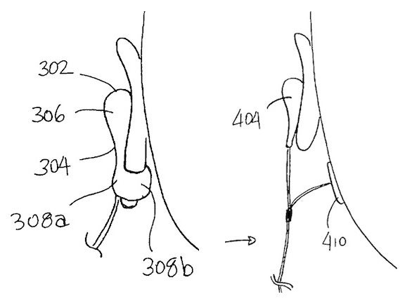 Eine weitere Patentzeichnung von Apple zeigt eine Art „Clip“ welcher das Ohrläppchen umschließt oder einen separaten Sensor an der Gesichtshaut. (Quelle: MacRumors.com)