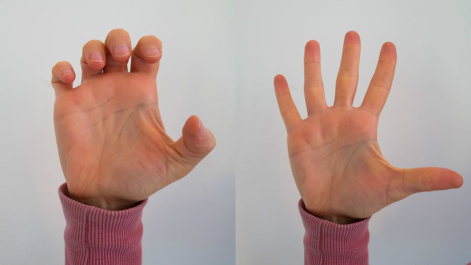 Variante 1: Die Finger im mittleren Gelenk zu einer Klaue anwinkeln und für fünf bis zehn Sekunden in dieser Position halten.
Variante 2: Die Finger erneut zu einer Klaue anwinkeln und langsam über einen Zeitraum von etwa zehn Sekunden die Hand öffnen.