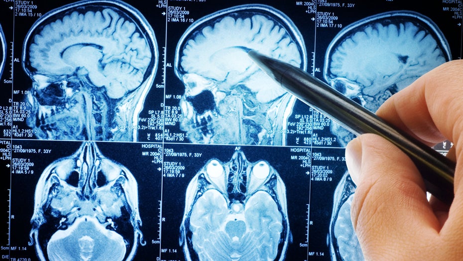 Forscher: „Wir tun unserem Gehirn mit der aktuellen Mediennutzung keinen Gefallen“