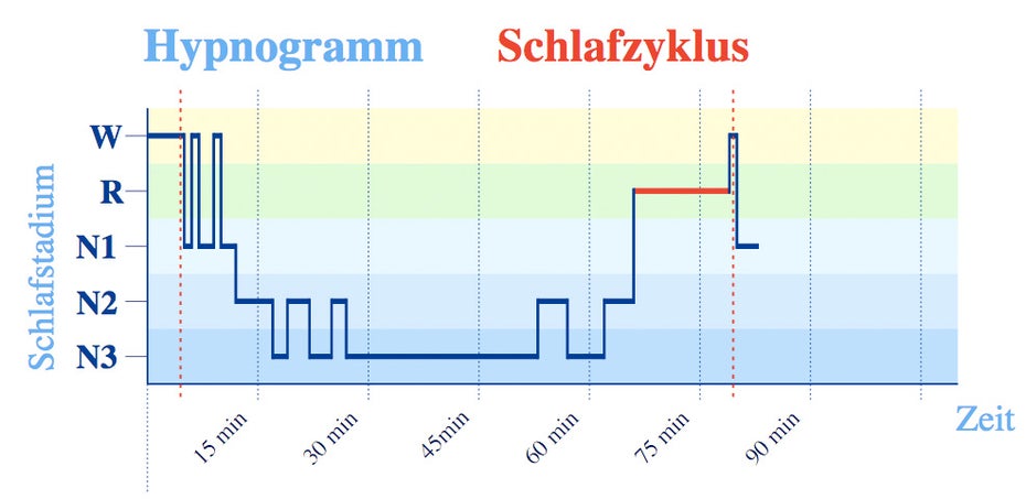 Hypnogramm mit einem Schlafzyklus – hier folgte nach kurzem „Wachliegen“ (W) etwas Leichtschlaf (N1), unterbrochen von erneutem Wachwerden, danach etwas Schlaf der Stadien N2 und ausgiebig Tiefschlaf (N3) sowie 13 Minuten REM-Schlaf (R). (Grafik: Wikipedia)