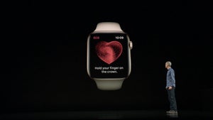 Was Kardiologen zur neuen EKG-Funktion der Apple Watch sagen