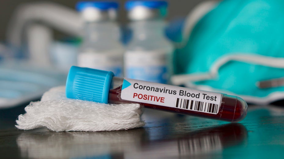 Coronavirus: Deine Rechte und Pflichten im beruflichen Umfeld Coronavirus: Deine Rechte und Pflichten im beruflichen Umfeld