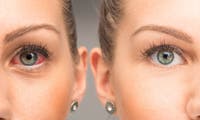 Augen-Scan: Diese App soll den Coronatest ersetzen können
