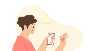 Google will die Hautkrebsdiagnose erleichtern – und erntet Kritik