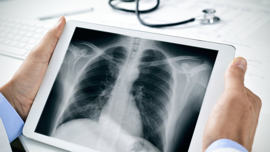 Irland: Erste Patientendaten nach Ransomware-Angriff im Netz aufgetaucht Irland: Erste Patientendaten nach Ransomware-Angriff im Netz aufgetaucht