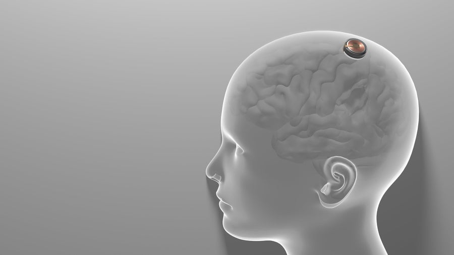 China vs. Neuralink: Wer gewinnt das Rennen um die Brain-Computer-Interfaces?