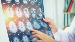 Ein einziger Gehirnscan statt dutzende Untersuchungen: Wie KI künftig Demenz erkennen soll