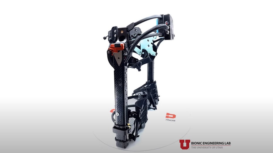 Robo-Bein: Dieses Exoskelett lässt Einbeinige normal gehen