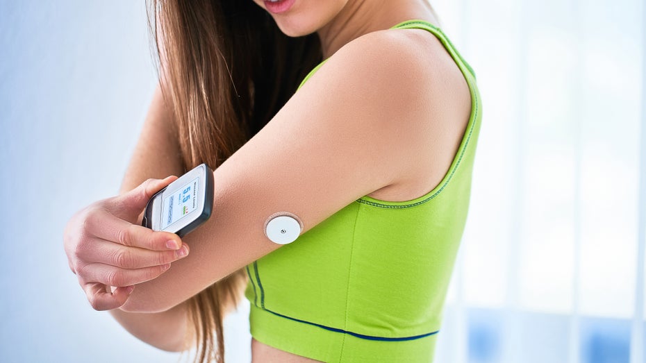 Open-Source: Automatisierte Insulinzufuhr der Marke Eigenbau – und was die Medizin dazu sagt Open-Source: Automatisierte Insulinzufuhr der Marke Eigenbau – und was die Medizin dazu sagt