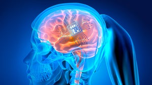 Neuralink will Hirnimplantate am Menschen testen