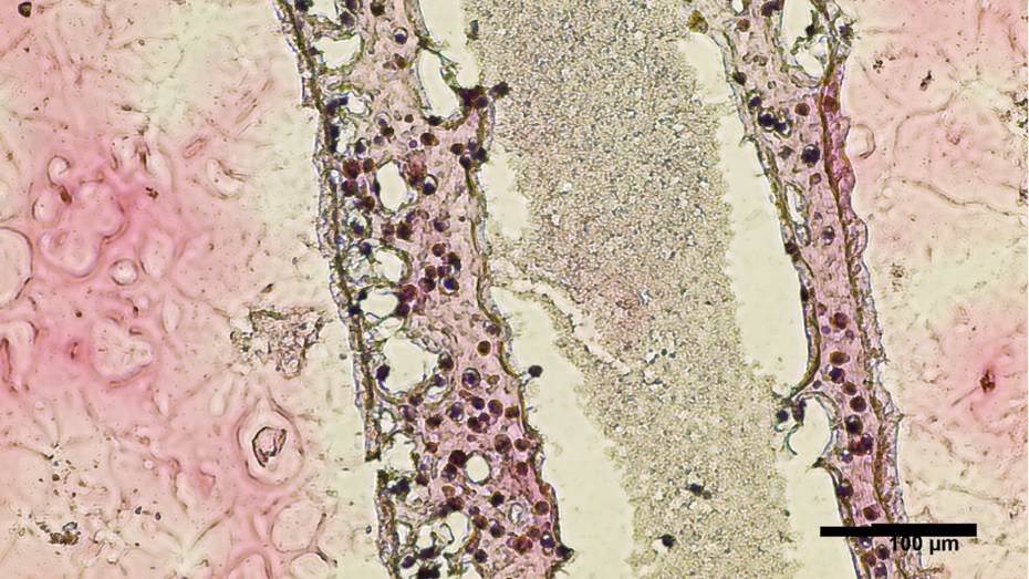Hoden aus dem 3D-Drucker: Wissenschaftler wollen künstliches Sperma produzieren Hoden aus dem 3D-Drucker: Wissenschaftler wollen künstliches Sperma produzieren
