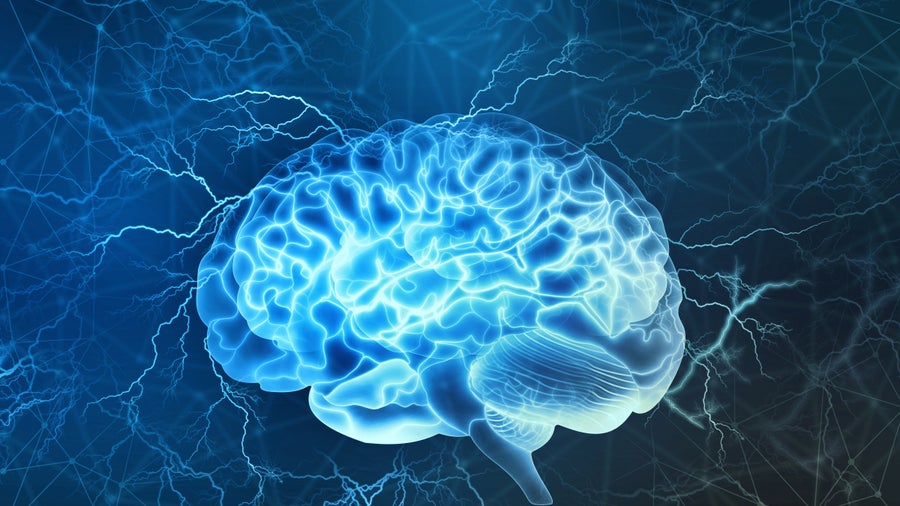 Studie: Unsere Gehirne werden immer größer