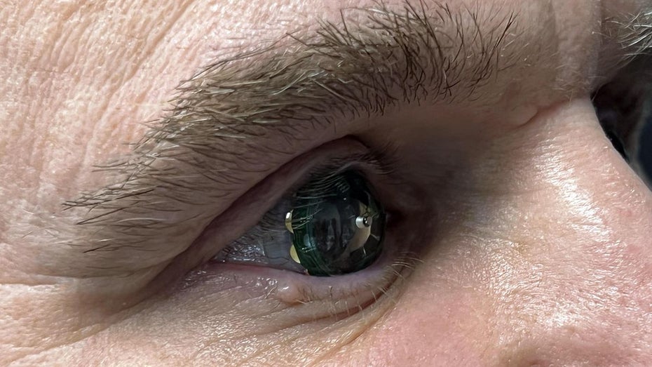 Hat da was im Auge: Mojo-Vision-CEO Drew Perkins trägt AR-Kontaktlinse. (Bild: Mojo Vision) Mojo Lens: Premiere für AR-Kontaktlinse – im Auge des Chefs persönlich