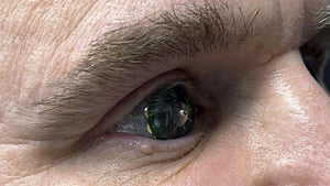 Mojo Lens: Premiere für AR-Kontaktlinse – im Auge des Chefs persönlich