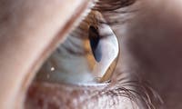 Künstliche Hornhaut gibt 14 Menschen das Augenlicht zurück