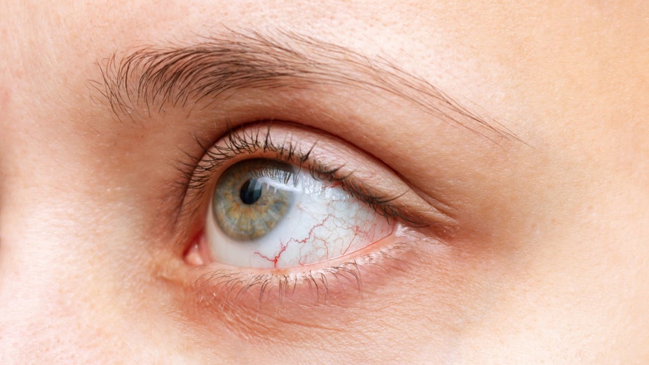 KI-Anwendung soll Herzerkrankungen und Schlaganfallrisiko durch Augenscan erkennen