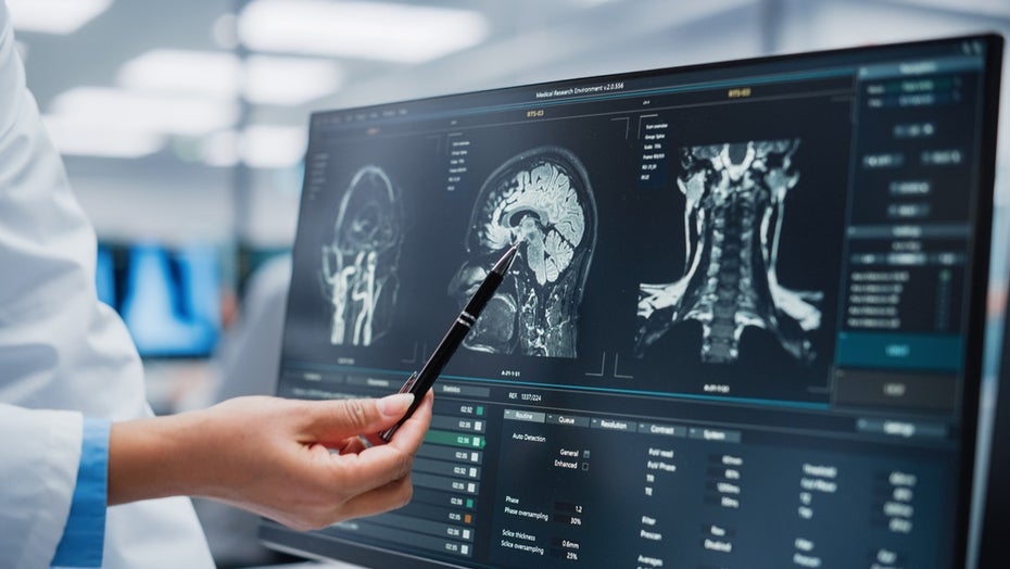 Mit MRT und KI: Wissenschaftlern gelingt „Gedanken lesen“ Das Gehirn ist in vielen Bereichen noch immer ein Rätsel. (Foto: Gorodenkoff/Shutterstock)