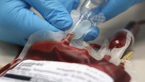 Erstmals im Labor entstandenes Blut Menschen verabreicht