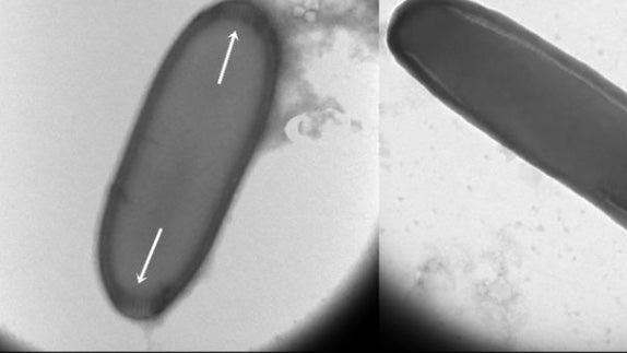Viren aus dem Permafrostboden Sibiriens. (Bild: biorxiv) 50.000 Jahre alt: Forscher erwecken „Zombie-Viren“ zum Leben