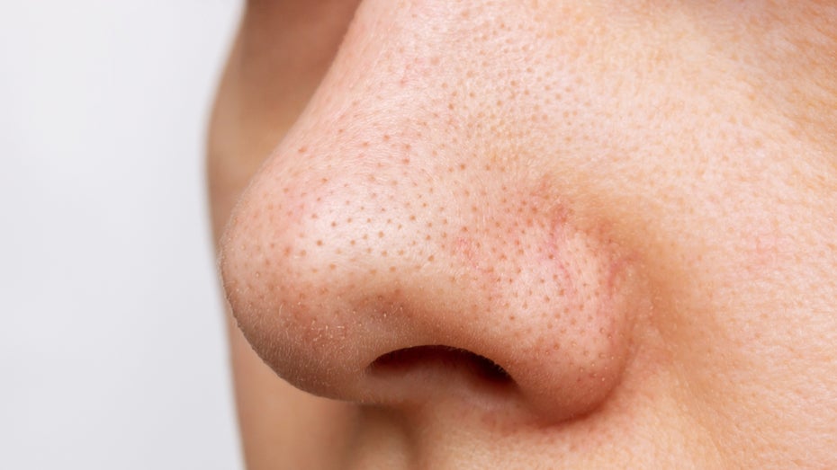 E-Nase: Wie Implantate den Geruchssinn zurückbringen sollen