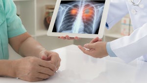 Vorsorge gegen Lungenkrebs: MIT und Krankenhaus entwickeln KI-System