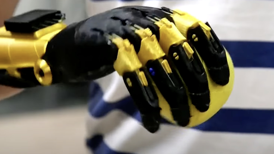 Teenager bauen einem Mitschüler eine funktionierende Roboterhand