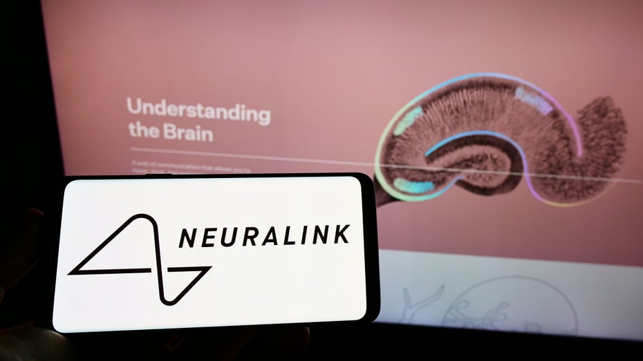 Neuralink und Co: Gehirnimplantate verändern laut Forschern die Persönlichkeit