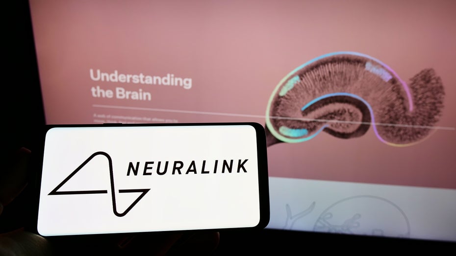 Neuralink-Patient spielt Onlineschach: Warum ein Experte keinen Durchbruch sieht