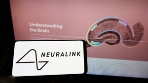 Neuralink und Co: Gehirnimplantate verändern laut Forschern die Persönlichkeit