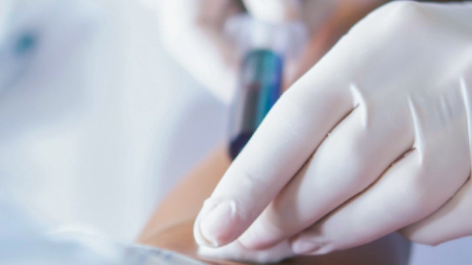 Ein wenig Blut soll ausreichen, um Krebs zu erkennen. (Foto: Grail) „Revolutionärer“ Bluttest: Hunderte Patienten bekommen falsche Krebsdiagnose