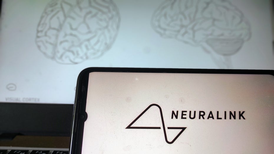 Neuralink Gehirnimplantat