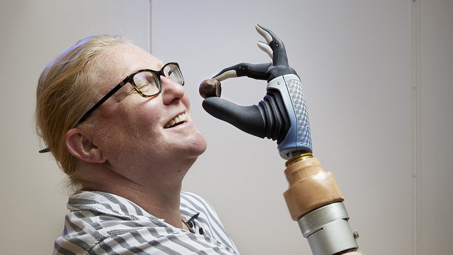 Prothese der Zukunft: Mechanische Hand mit menschlichem Nerven- und Skelettsystem verbunden