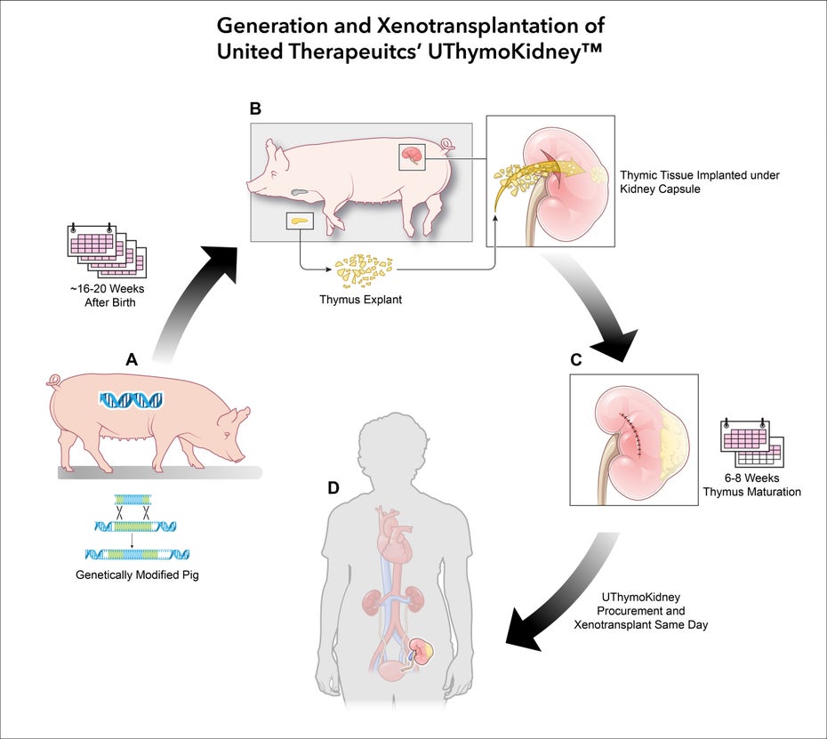 Grafik zur Produktion der genetisch veränderten Schweineniere