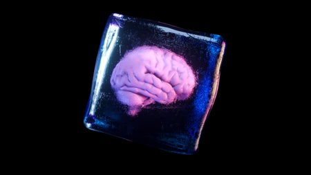 Kryotechnik: Wissenschaftler tauen erstmals gefrorenes Gehirngewebe erfolgreich auf
