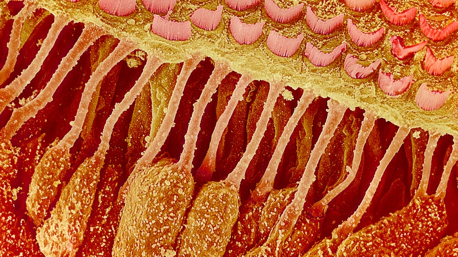 Endlich kein Tinnitus mehr: Neue Therapien sollen die Ursache der Töne im Ohr behandeln Endlich kein Tinnitus mehr: Neue Therapien sollen die Ursache der Töne im Ohr behandeln