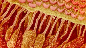 Endlich kein Tinnitus mehr: Neue Therapien sollen die Ursache der Töne im Ohr behandeln