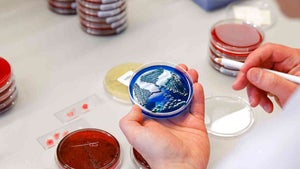 Blutanalyse in Stunden statt Tagen: So diagnostizieren Jenaer Forscher Infektionen mit Laserlicht