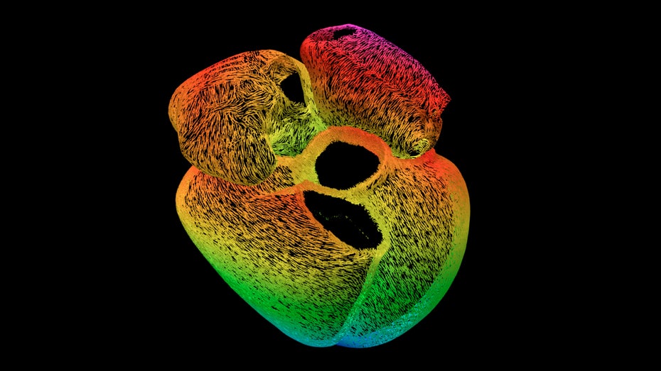 Computertomografie eines insuffizienten Herzens. Die Linien, die sich über das Herz ziehen, zeigen die Ausrichtung der Muskelfasern an. (Bild: Marina Strocchi) Der Weg zum digitalen Herz: Für neue Therapien wollen Mediziner alle Organe virtuell nachbilden