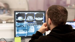 Wissenschaftler scannen 100.000 Körper per MRT: Wozu die Daten dienen und welche Herausforderungen es gibt